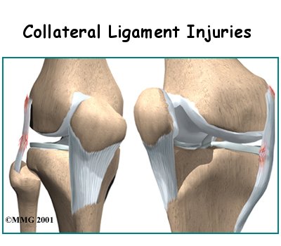 Collateral Ligament Injuries